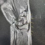 손목건초염 원인과 증상, MRI 결과와 스테로이드 부작용 & 드퀘르벵 수술