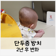 아기 단두증 교정 무조건 하세요