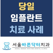 당일 임플란트 수술 장위동치과 서울바른닥터치과