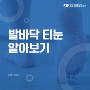 당감동 피부과 발바닥 티눈 알아보기