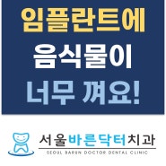 임플란트 주위로 음식물이 너무 껴요 처음에는 괜찮았는데 [월곡역치과 서울바른닥터치과]