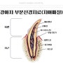 [광주 치과 동물병원, 금호동 동물병원, 강아지 신경치료, 강아지 부분신경치료, 강아지 치아파절] 강아지도 신경치료가 가능할까요?