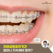 치아교정 유지기간을 얼마나 지속해야 할까?