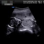 임신기록 임신 중기- 16주~24주/ 정밀초음파 / 임당검사 / 입체초음파
