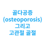 골다공증(osteoporosis)과 고관절 골절의 위험성