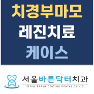 치경부 마모증 레진치료 [월곡역치과 서울바른닥터치과]