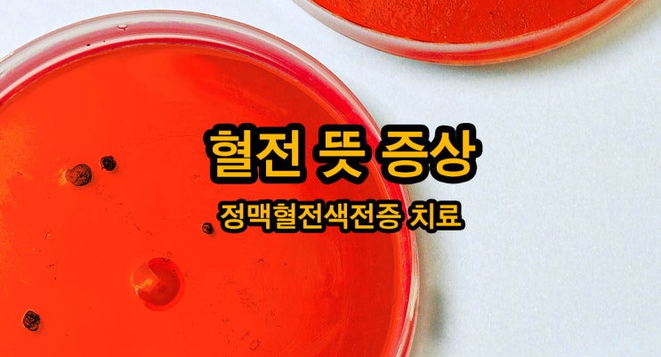 혈전 뜻 및 증상 다리 정맥혈전색전증 치료 : 네이버 블로그