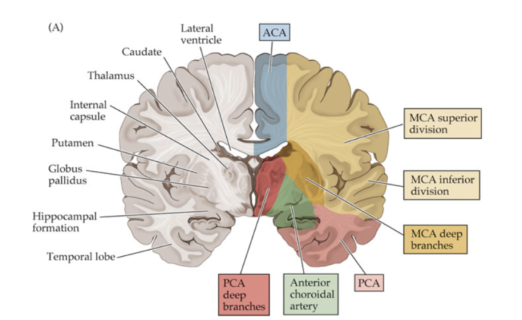 뇌경색 (Brain infarction) 공부 : 네이버 블로그