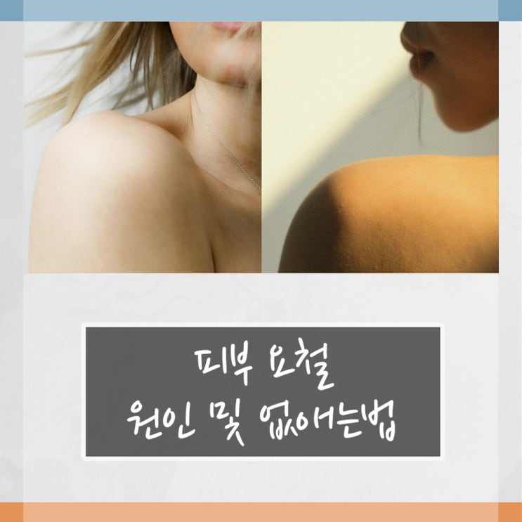 피부 요철 원인 및 없애는법 : 네이버 블로그