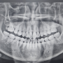 [제물포 치과 추천] 일미리 치과의원 | 친절하고 정직한 진료 치과 추천 내돈내산 솔직후기