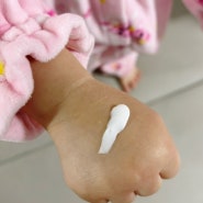 몽디에스 아토크림 아기동전습진 아기습진크림으로 사용