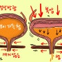 요실금 병원에서 알려주는 오줌못참는 빈뇨증상