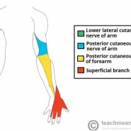 팔저림, 팔의 마비를 일으키는 요골신경마비(Radial nerve palsy)는 어떤 질환일까요?