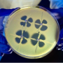 CRE, CPE, VRSA, VRE, MRSA, MRPA 항생제내성균 감염 격리 병실 입원, 재활 가능 | 천안 요양병원