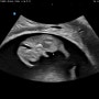 임신7주-9주. 무기력증과의 싸움, 태아보험 가입 꿀팁