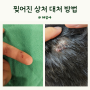 찢어진 상처 봉합 병원 정보 머리 손가락 상처 꼬매기 후기