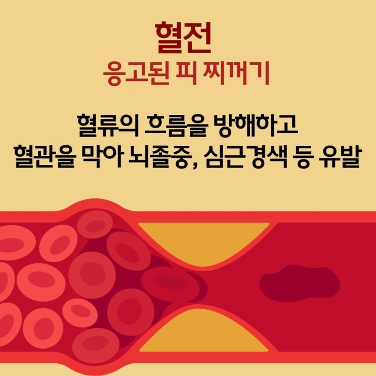 혈전 증상 위험성 혈관 청소 필요성 파악할 것! : 네이버 블로그