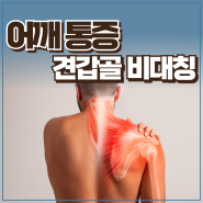마포 서대문 신촌 견갑골 불균형·어깨 통증 운동재활 PT