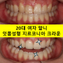 잇몸 성형과 치아미백 그리고 지르코니아 20대 앞니 크라운 치료. 치료과정/기간/비용. 행당동 치과.