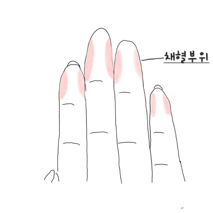 BST측정방법/BST check/혈당검사/간호조무사BST/실습BST : 네이버 블로그
