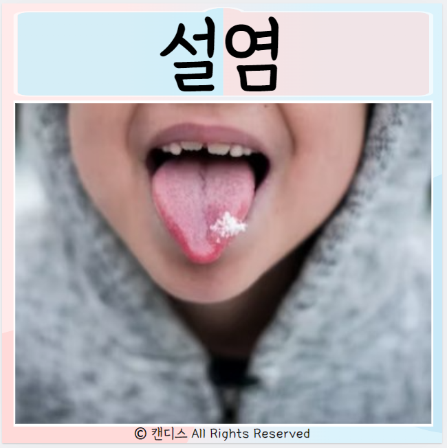 설염 원인 증상 관리방법 구강관리 : 네이버 블로그