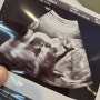 임신 16주차 ~ 26주차 | 성별 | 괌 태교여행 | 임당검사 | 임당재검당첨 | 육아용품준비 당근템