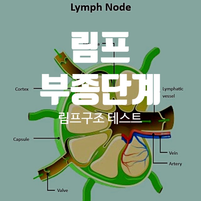 림프 구조와 기능, 림프부종 검사방법 ( T세포, B세포) , 림프부종의 단계 : 네이버 블로그