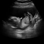 [임신일기 13~16주차] 조리원예약, 베이비페어, 부부태교교실, 성별확인