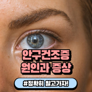 눈이 뻑뻑해 시리다면 안구건조증 원인과 증상 관리법 알기