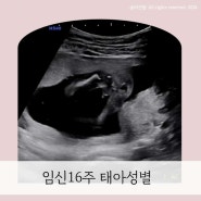 임신16주 성별 태아성별시기 , 아들 딸 초음파 비교 (둘다 있음)
