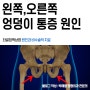 왼쪽 오른쪽 엉덩이 아래(밑)통증 (ft. 양반다리)