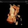 [임신 37주차] 이대서울병원 출산 전 막달검사 (산모종합검사)
