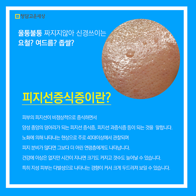 청담피부과 얼굴요철 해결했어요 : 네이버 블로그