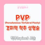 [신경외과 시술] PVP(Percutaneous vertebral plasty) 경피적 척추 성형술