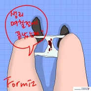 생리 후 부정출혈 자궁내출혈 의미하므로