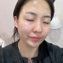 군산 미룡동 피부관리 효과좋은mts관리 봄에스테틱