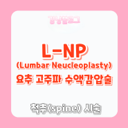 [신경외과 시술] L-NP(lumbar neucleoplasty) 요추고주파수액감압술 척추시술 수액감압술 디스크수액감압술