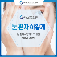 눈 흰자 하얗게 하기 위한 치료와 생활 팁