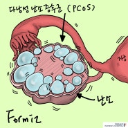 생리불순 원인 찾고 정상생리주기 돌리려면