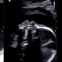 [임신기록] 임신17주~23주차 증상들ㅣ첫 태동ㅣ정밀초음파ㅣ몸무게증가