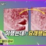 [유튜브]안면홍조환자 절대 금기시술 1부, 홍조치료시 금기사항!