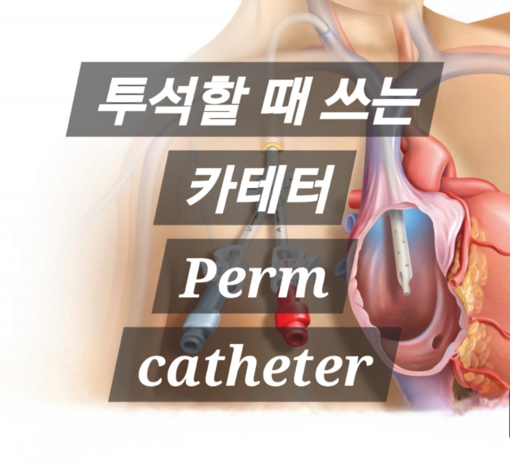 [투석할 때 쓰는 catheter] Perm catheter : 네이버 블로그