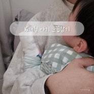 16개월 아기 열, 크룹 의심 눈꼽감기 콧물 탈수