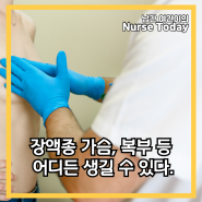 장액종 가슴, 복부 등 어디든 생길 수 있다.