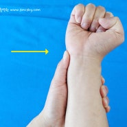 새끼손가락 손목통증 원인, 삼각섬유연골복합체 파열(tfcc) 증상 및 치료 병원, 운동 마사지