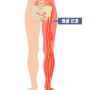 좌골신경통 증상 및 치료 (다리저림, 이상근증후군)