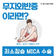 [부산힘찬병원] 최소 침습 무지외반증 수술 MICA 수술이란?