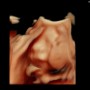 임신 28주 기록 - 입체초음파