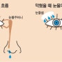 경기광주안과 눈물흘림증의 증상과 치료방법은?