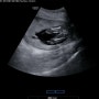 임신일기#4 드디어 알게 된 성별! 그리고 산부인과 전원 (13~16주차)